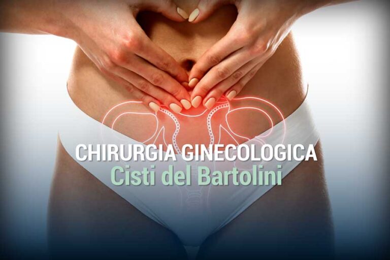 Cisti del Bartolini