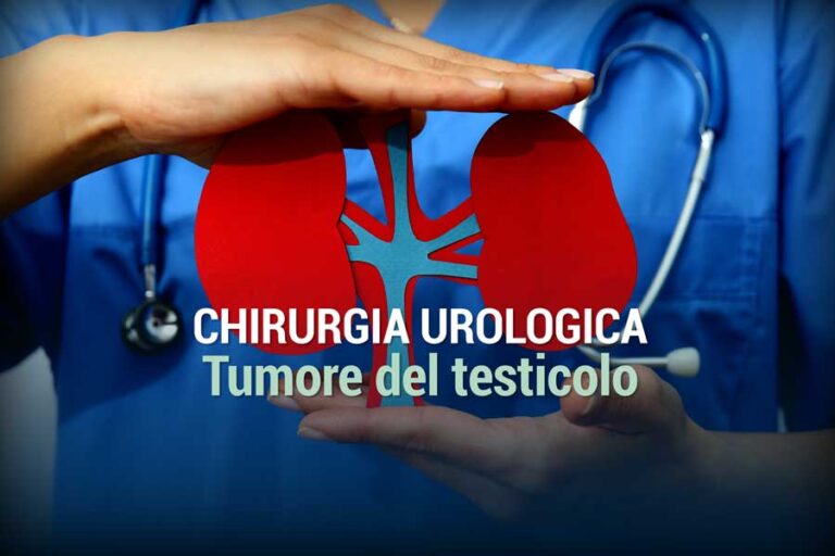 Tumore del testicolo