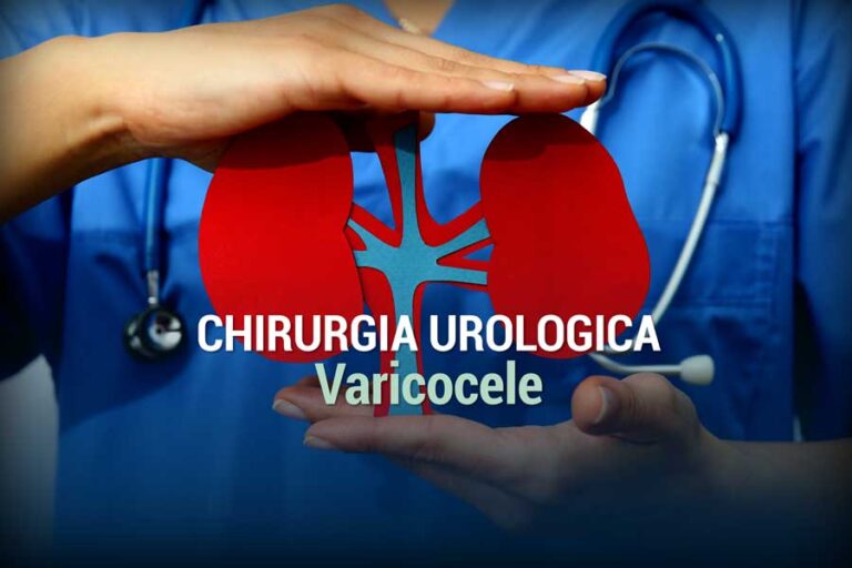 Varicocele